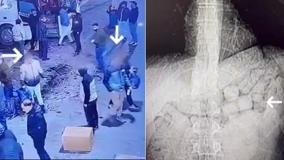 Diyarbakır’da Midelerinde Uyuşturucu Taşıyan 2 İranlı Tutuklandı