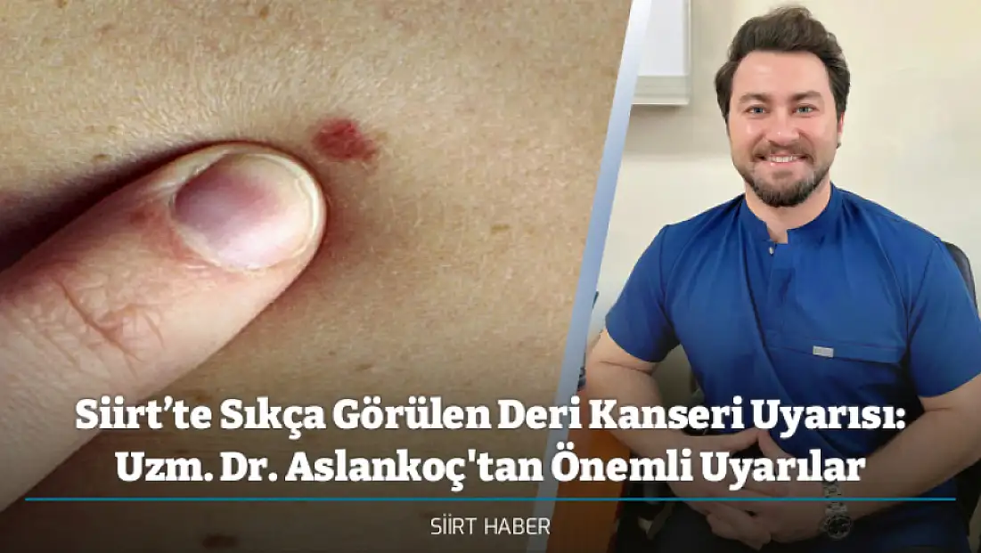Siirt’te Sıkça Görülen Deri Kanseri Uyarısı: Uzm. Dr. Aslankoç'tan Önemli Uyarılar