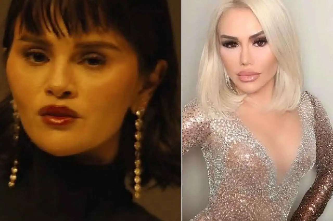 Selena Gomez'in Son Hali Sosyal Medyayı Salladı: Ceylan'a Benzetildi