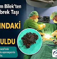 Siirt'te 88 Yaşındaki Hastaya Başarılı Mesane Taşı Ameliyatı