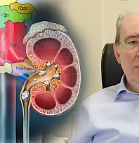 Siirt'te Böbrek Taşı Alarmı! Prof. Dr. Azmi Levent Sağnak Uyardı: İhmal Ölümcül Sonuçlar Doğurabilir