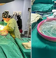 Siirt'te İlk Kez 'Alexis C-Section' Tekniği ile Sezaryen Ameliyatı Yapıldı