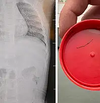 Sırtüstü yatırılan bebek hep ağladı, gerçeği öğrenen aile donup kaldı