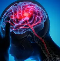 Uzmanlar uyardı: Beyni yorduğu öne sürülen 6 gıda