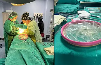 Siirt'te İlk Kez 'Alexis C-Section' Tekniği ile Sezaryen Ameliyatı Yapıldı