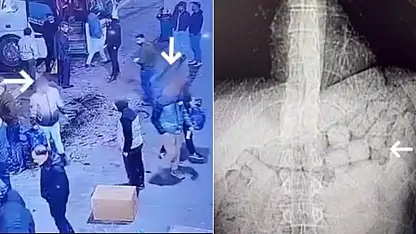 Diyarbakır'da Midelerinde Uyuşturucu Taşıyan 2 İranlı Tutuklandı