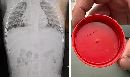 Sırtüstü yatırılan bebek hep ağladı, gerçeği öğrenen aile donup kaldı