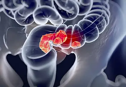 Vücudunuz Sinyal Veriyor: Kolorektal Kanserin Gizli Belirtileri