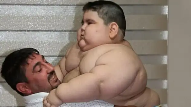 4 yaşında bu kiloya ulaştı!