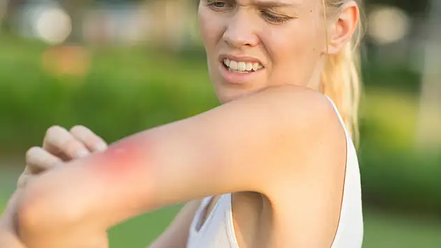 Arı Sokmalarında Adrenalin Otoenjektörü Hayat Kurtarıyor!