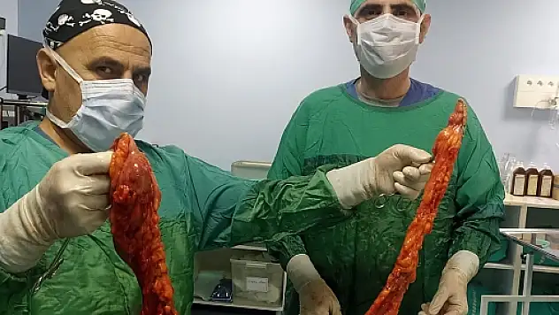 Doç.Dr.Akın Önder'den Başarılı Kolon Kanseri Ameliyatı