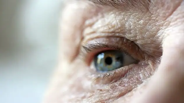 Kuru Tip Sarı Nokta Hastalığında Sevindiren Gelişme