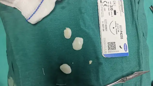 Ortopedi Doktoru Nihat Gezgin'den Başarılı Bir Ameliyat Daha 