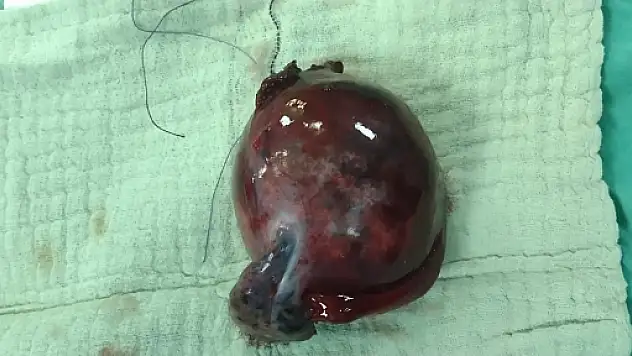 Siirt Hayat Hastanesi Şifa Dağıtmaya Devam Ediyor