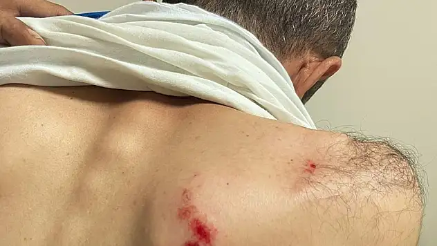 Siirt'te DİCLE Elektrik Saha Ekibine Saldırı