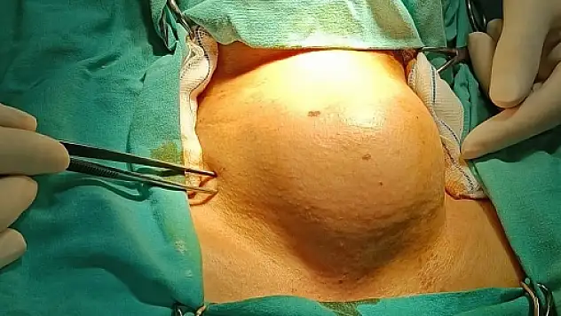 Üniversite Hastanesine Sevk Edilen Hasta Hayat Hastanesinde Şifa Buldu