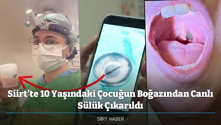 Siirt’te 10 Yaşındaki Çocuğun Boğazından Canlı Sülük Çıkarıldı