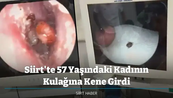 Siirt'te 57 Yaşındaki Kadının Kulağına Kene Girdi
