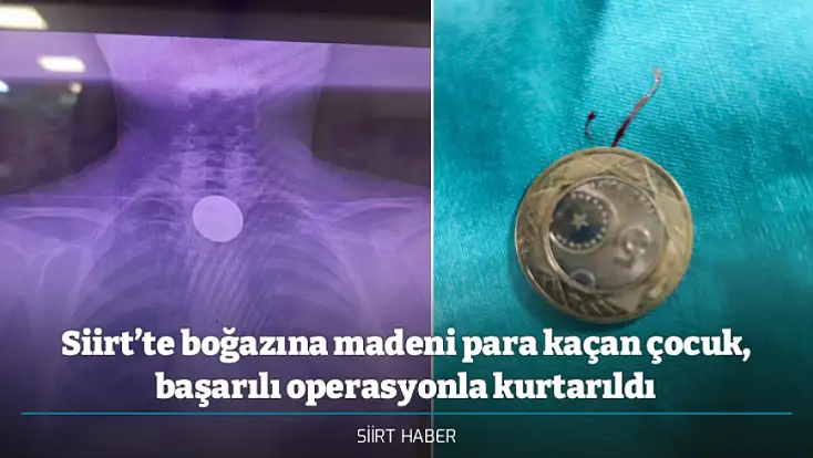 Siirt’te boğazına madeni para kaçan çocuk, başarılı operasyonla kurtarıldı