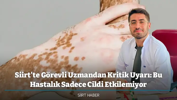 Siirt'te Görevli Uzmandan Kritik Uyarı: Bu Hastalık Sadece Cildi Etkilemiyor