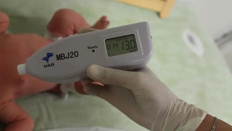 Siirt Eğitim ve Araştırma Hastanesine Transkütan Bilurubinmetre Cihazı Alındı