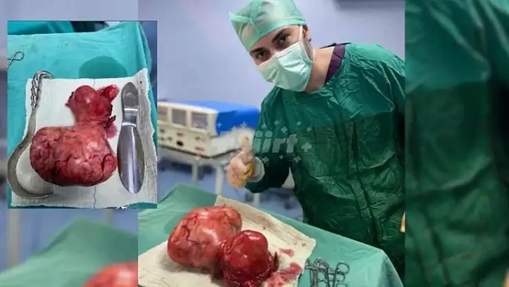 Myom Ameliyatı Olan Hasta Sağlığına Kavuştu