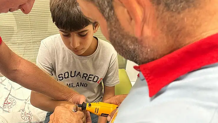 Parmağa Sıkışan Yüzük Kesilerek Çıkarıldı