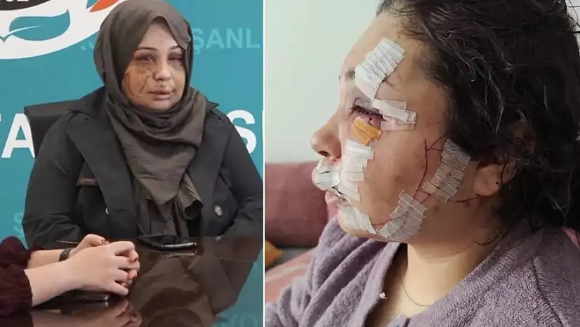 Eşine şiddet iddiası sonrası yeniden gözaltına alınan koruma polisi tutuklandı