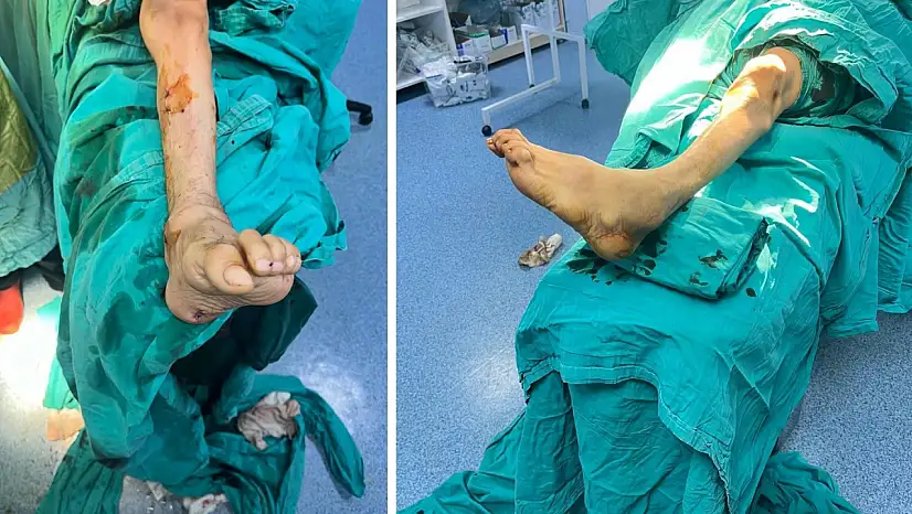 Siirt'te 77 yaşındaki engelli hasta ameliyatla sağlığına kavuştu