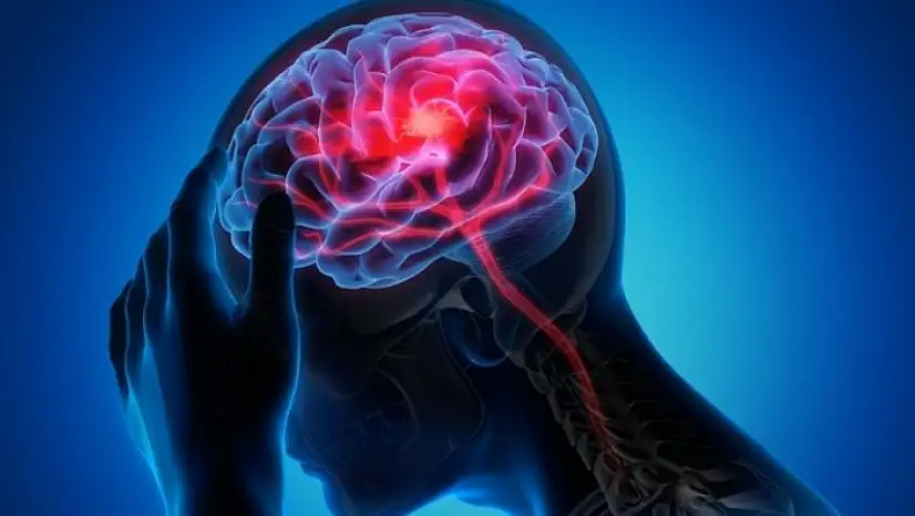 Uzmanlar uyardı: Beyni yorduğu öne sürülen 6 gıda