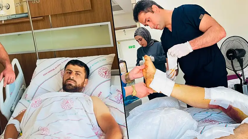 Siirt'te Beton Mikserine Kaptırdığı Bacağı Başarılı Ameliyatla Kurtarıldı