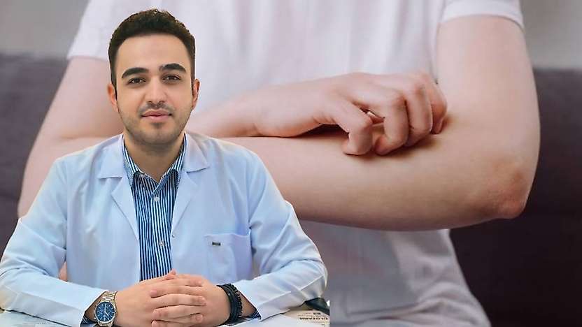 Siirt'te Dünya Ürtiker Günü Uyarısı: Kaşıntıyı Hafife Almayın