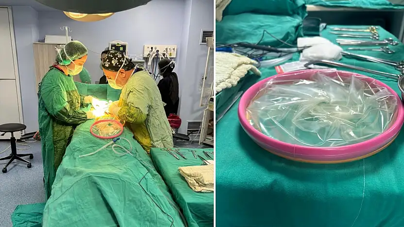 Siirt'te İlk Kez 'Alexis C-Section' Tekniği ile Sezaryen Ameliyatı Yapıldı