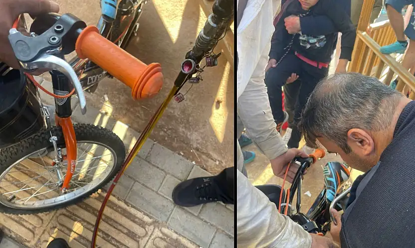 Siirt'te Ayağı Pedala Sıkışan Çocuğu İtfaiye Ekipleri Kurtardı!