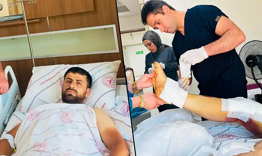 Siirt'te Beton Mikserine Kaptırdığı Bacağı Başarılı Ameliyatla Kurtarıldı