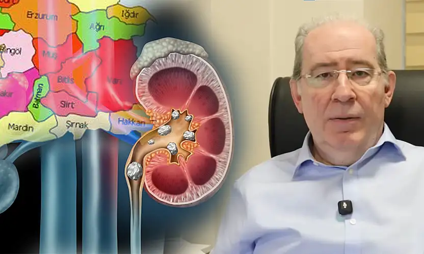 Siirt'te Böbrek Taşı Alarmı! Prof. Dr. Azmi Levent Sağnak Uyardı: İhmal Ölümcül Sonuçlar Doğurabilir