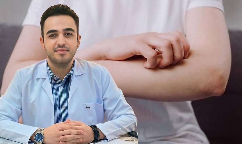 Siirt'te Dünya Ürtiker Günü Uyarısı: Kaşıntıyı Hafife Almayın