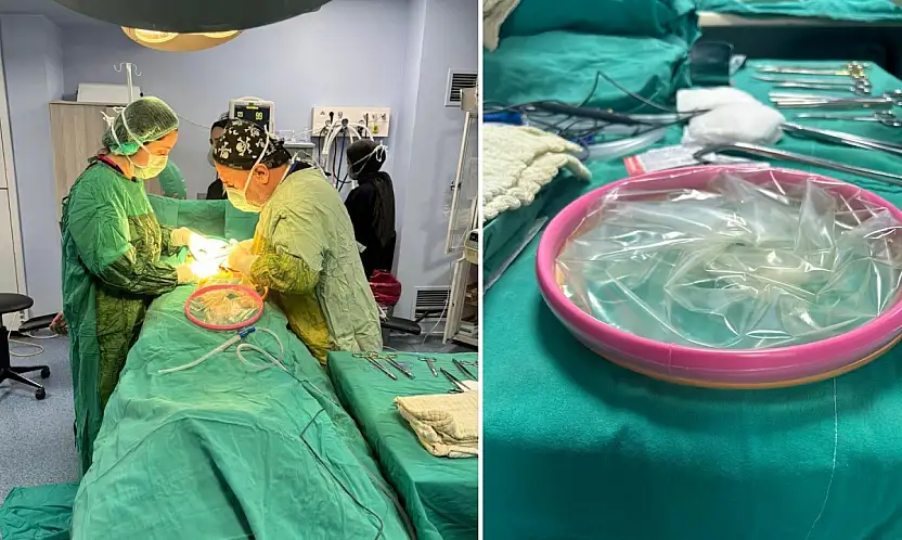 Siirt'te İlk Kez 'Alexis C-Section' Tekniği ile Sezaryen Ameliyatı Yapıldı