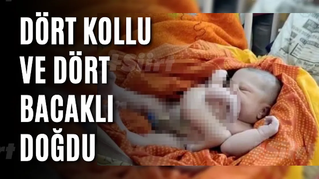 Dört kollu ve dört bacaklı doğdu