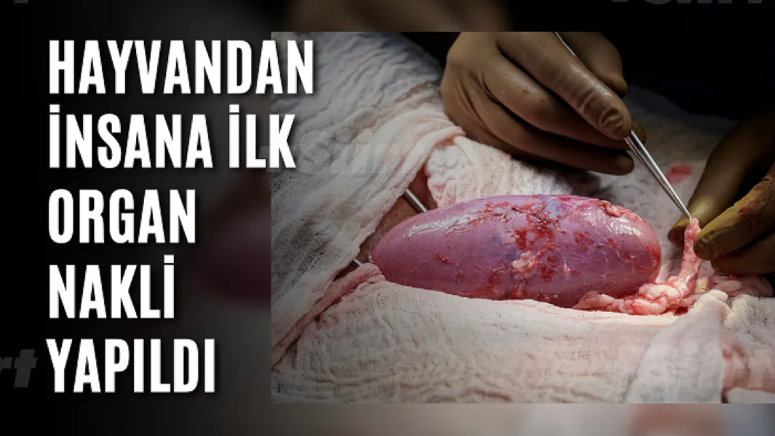 Hayvandan İnsana İlk Organ Nakli Yapıldı