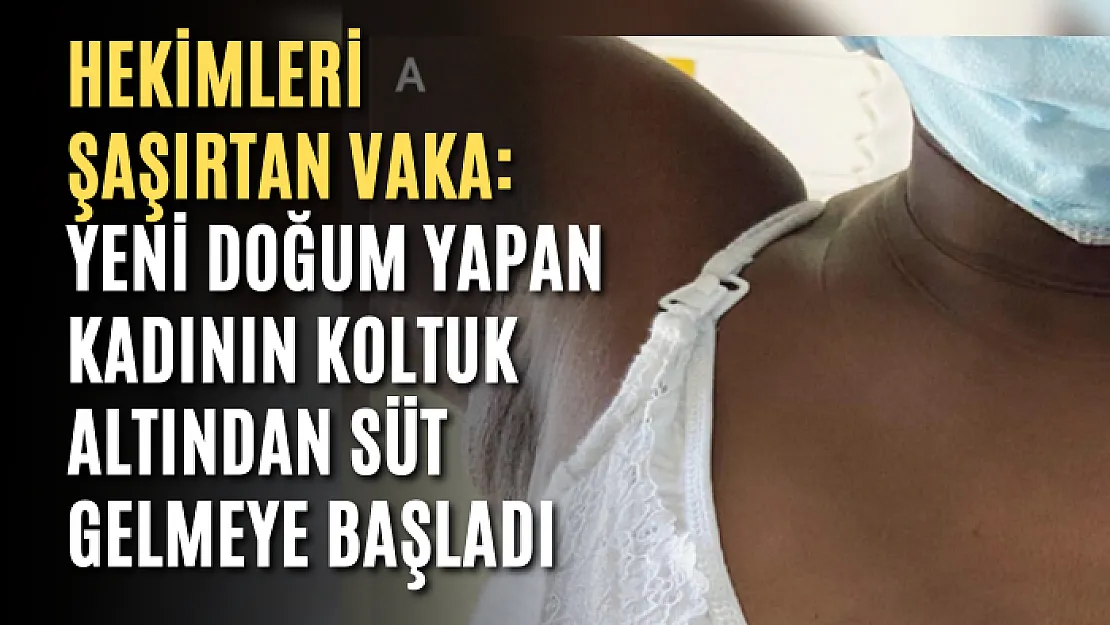 Hekimleri şaşırtan vaka: Yeni doğum yapan kadının koltuk altından süt gelmeye başladı