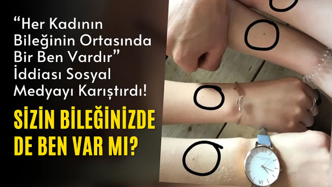 'Her Kadının Bileğinin Ortasında Bir Ben Vardır' İddiası Sosyal Medyayı Karıştırdı! Sizin Bileğinizde de Ben Var mı?