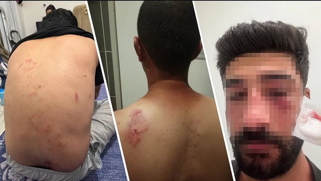 Kurtalanlı 8 Kişilik Aileye Mersin'de Irkçı Saldırı İddiası
