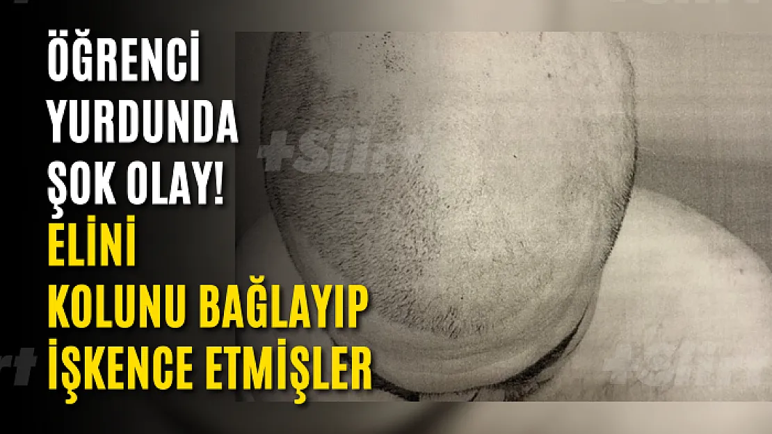 Öğrenci Yurdunda Şok Olay! Elini Kolunu Bağlayıp İşkence Etmişler