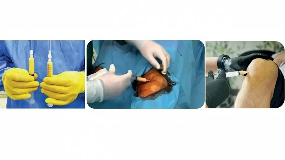 Özel Siirt Hayat Hastanesi'nde Kök Hücre Tedavisi Başladı