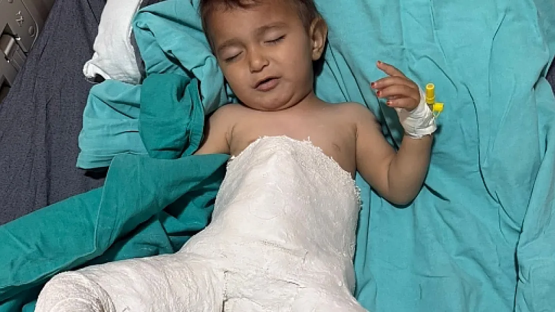 Siirt'te 15 Aylık Bebek, Başarılı Kalça Çıkığı Ameliyatıyla Sağlığına Kavuştu