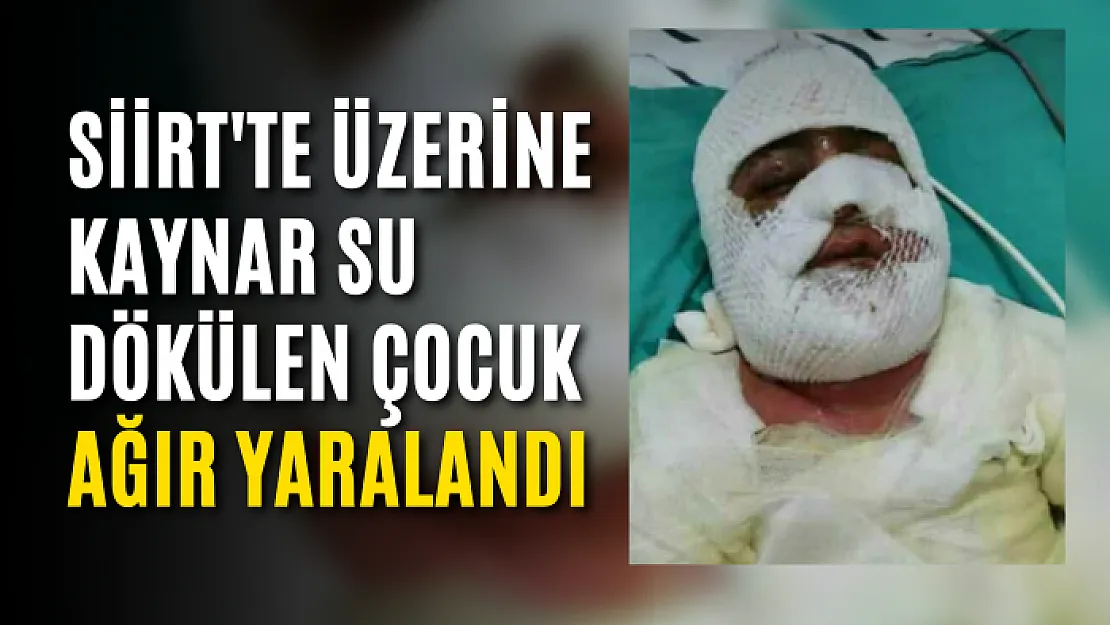 Siirt'te Üzerine Kaynar Su Dökülen Çocuk Ağır Yaralandı