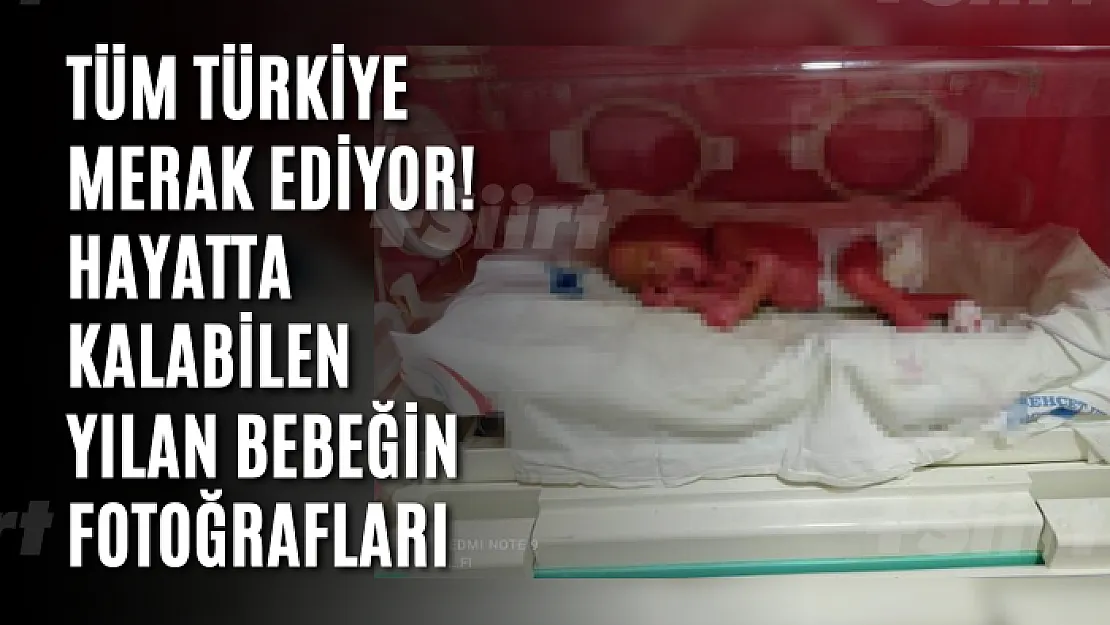 Tüm Türkiye merak ediyor! Hayatta kalabilen yılan bebeğin fotoğrafları