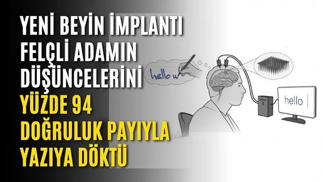 Yeni beyin implantı felçli adamın düşüncelerini yüzde 94 doğruluk payıyla yazıya döktü