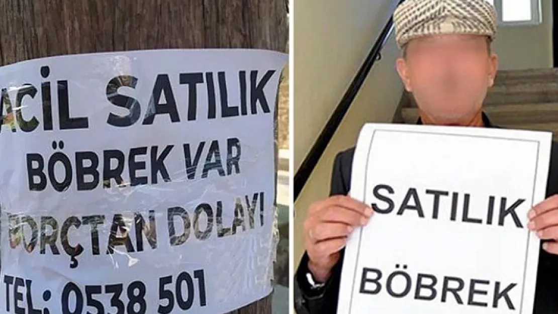 Yoksulluktan sosyal medyada 'organlarını' satmaya başladılar